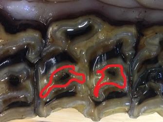 上面脸颊牙的表面的图象与infundibulum的突出显示用红色标记